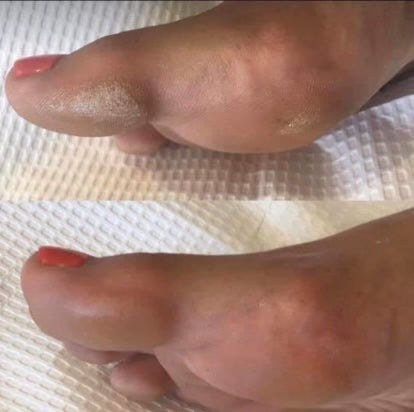Sole Solution Foot Treatment 👣