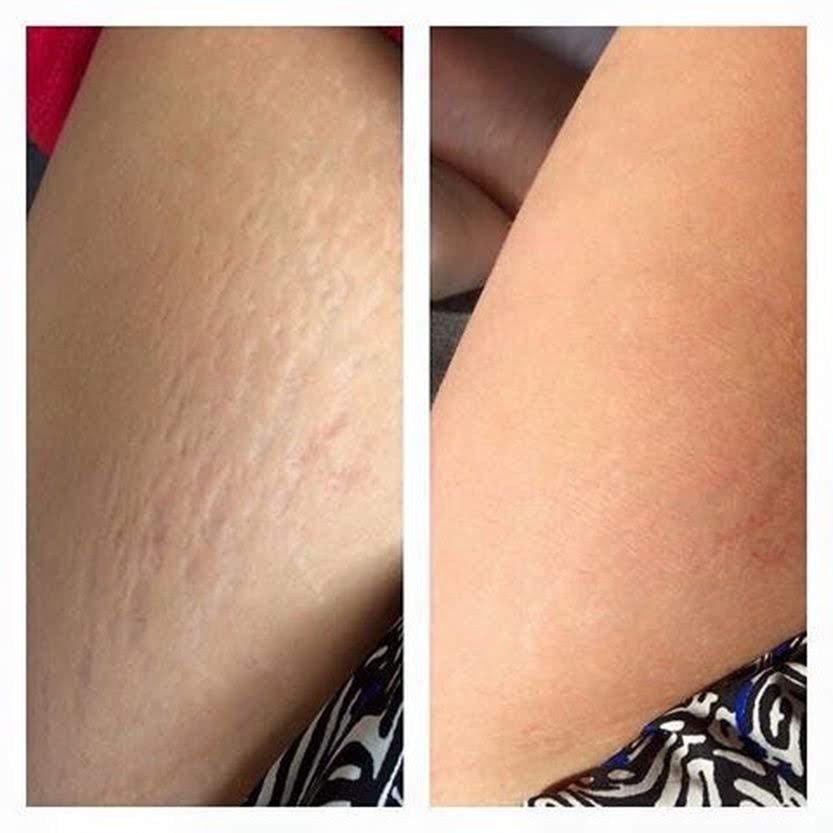 Epoch Baobab Body Butter đ§LIMITED DEAL!