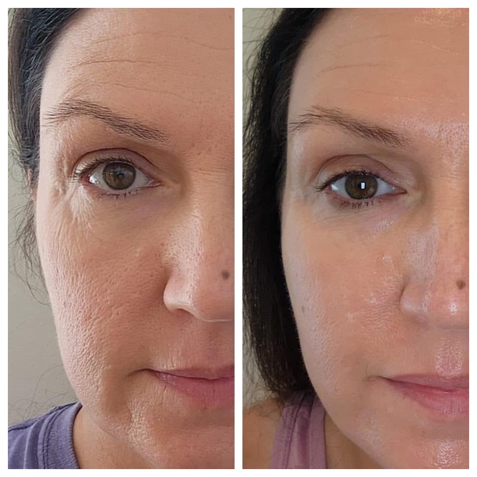 ageLOC® Tru Face® Peptide Retinol Complex + Uplifting Cream Bundle