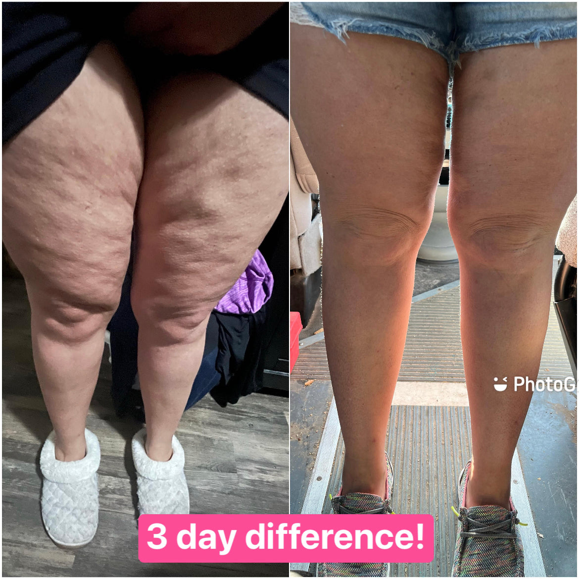 ageLOC Dermatic Effects 🧴