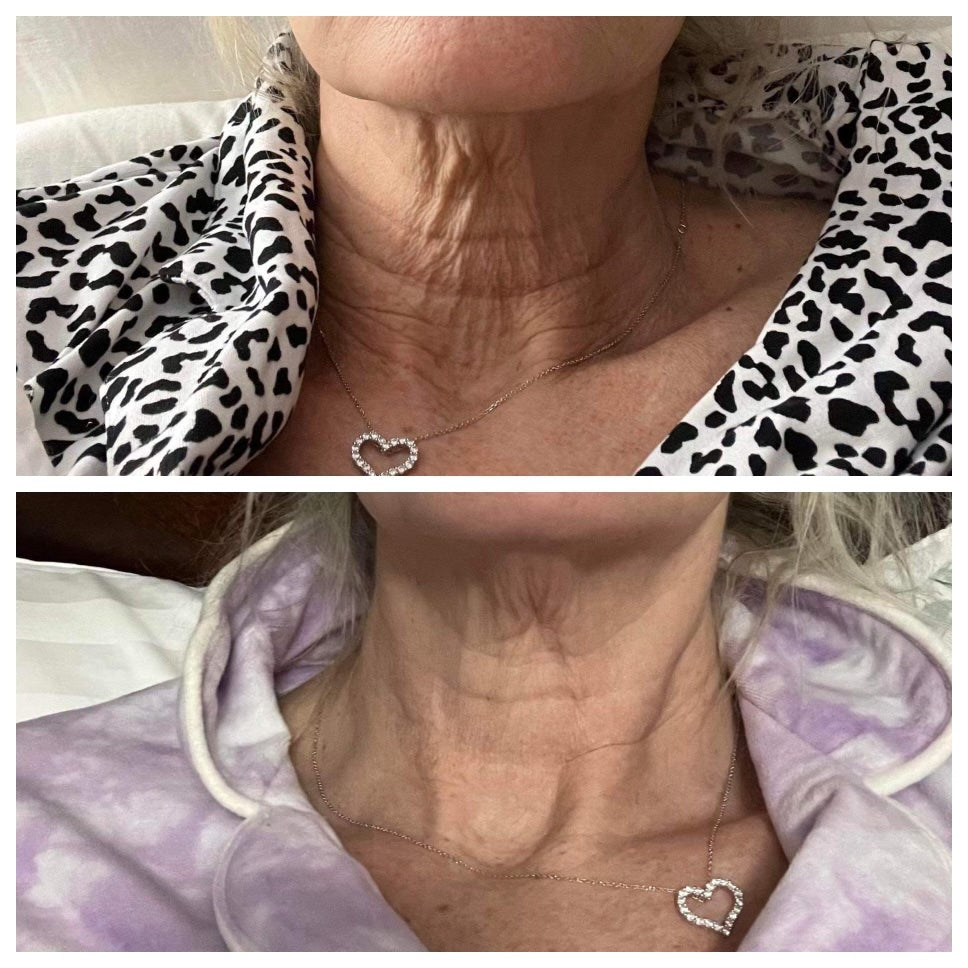 ageLOC Dermatic Effects : Body Contouring Lotion - SPECIAL BUNDLE SAVINGS!