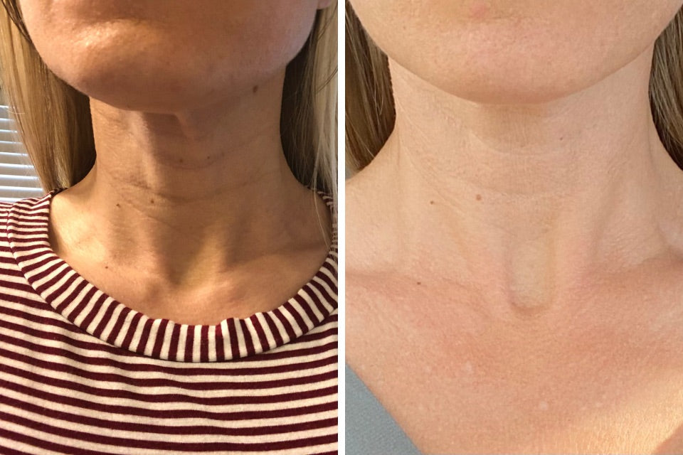 ageLOC Dermatic Effects 🧴