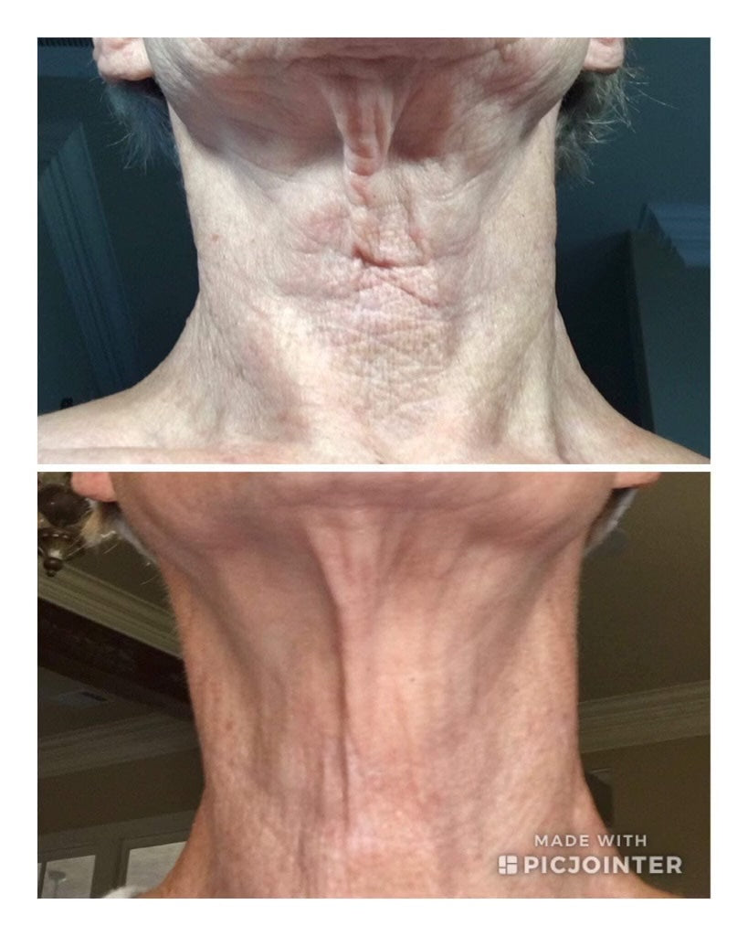 ageLOC Dermatic Effects : Body Contouring Lotion - SPECIAL BUNDLE SAVINGS!
