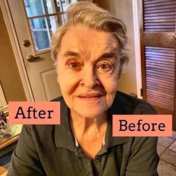 Face Lift with Activator Bundle