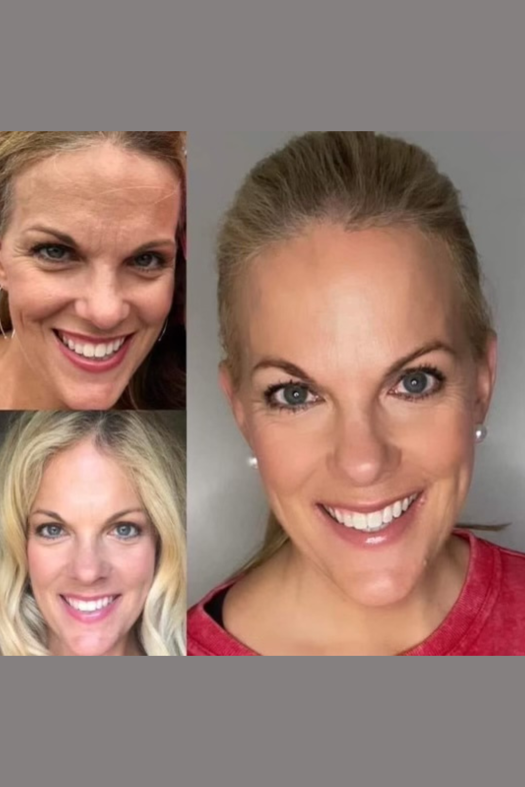 Powerhouse Anti-aging Bundle - **LIMITED BUNDLE**