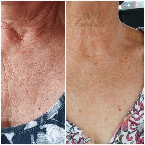 ageLOC Dermatic Effects : Body Contouring Lotion - SPECIAL BUNDLE SAVINGS!