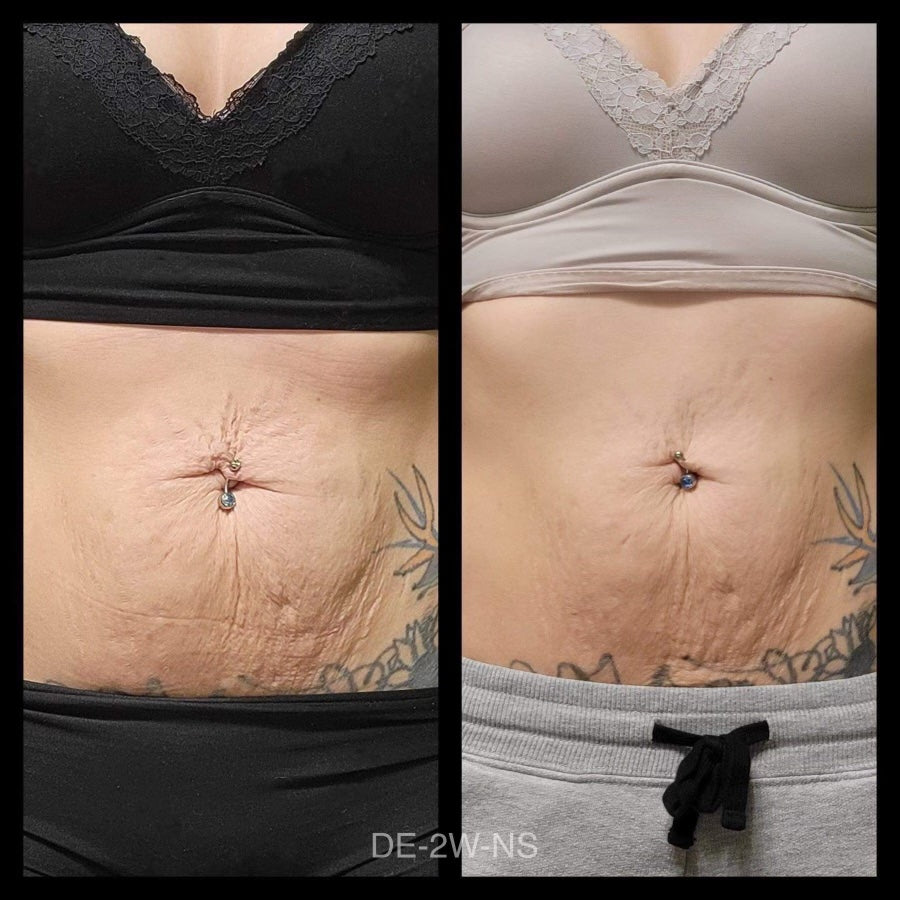 ageLOC Dermatic Effects : Body Contouring Lotion - SPECIAL BUNDLE SAVINGS!