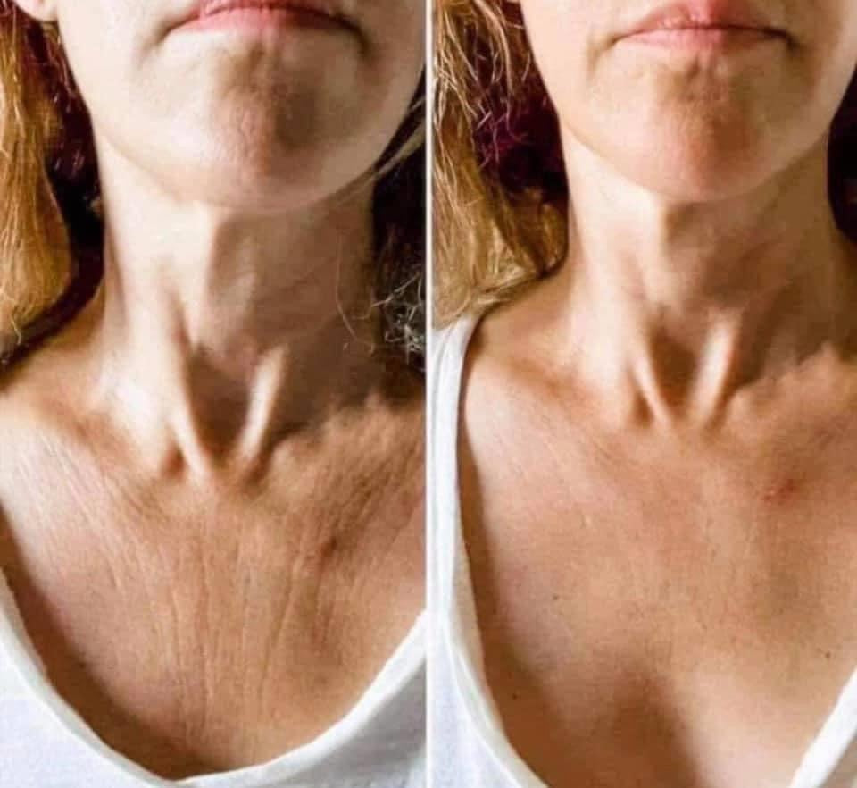 ageLOC Dermatic Effects : Body Contouring Lotion - SPECIAL BUNDLE SAVINGS!