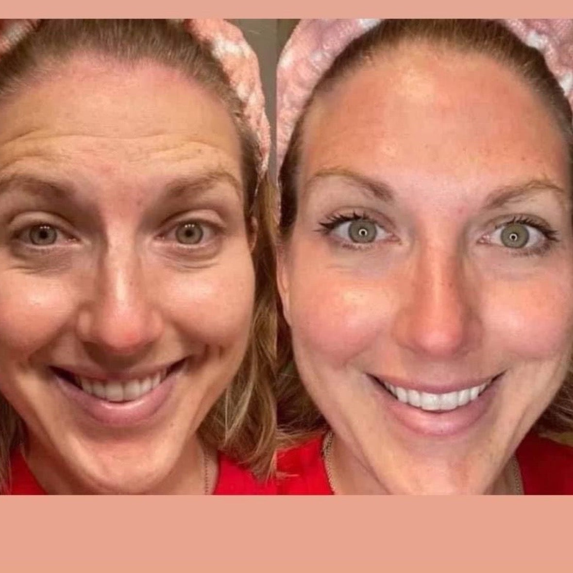 Face Lift with Activator Bundle