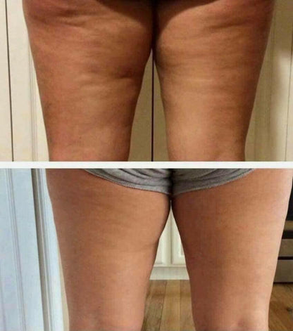ageLOC Dermatic Effects : Body Contouring Lotion - SPECIAL BUNDLE SAVINGS!