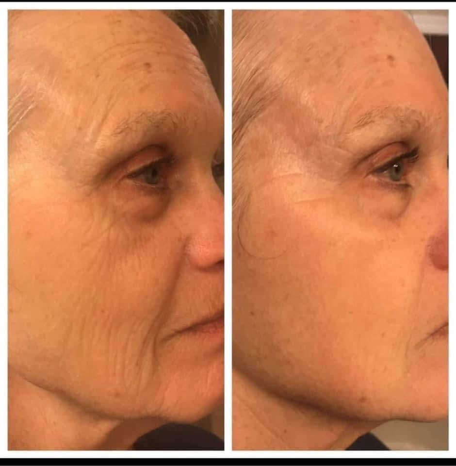 Face Lift with Activator (AKA Botox in a bottle) DOORBUSTER DEAL