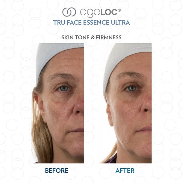 ageLOC® Tru Face® Essence Ultra DEAL