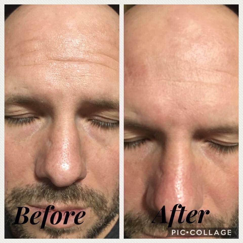 Face Lift with Activator (AKA Botox in a bottle) DOORBUSTER DEAL