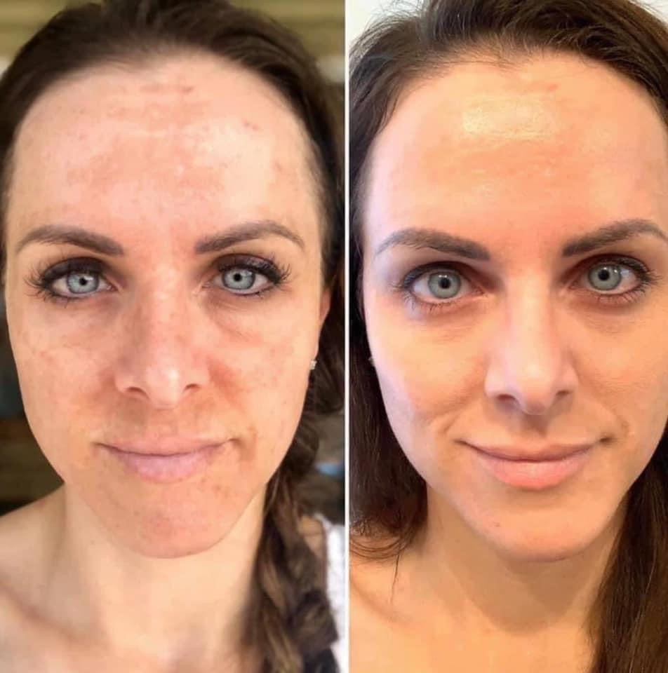 180°® Vitamin C Face Wash/ AHA facial peel bundle