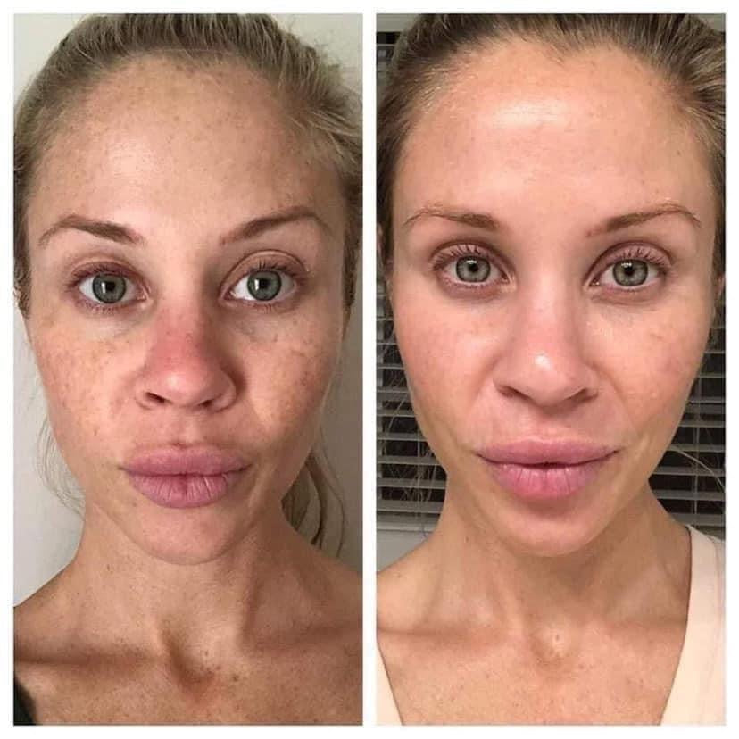 180°® Vitamin C Face Wash/ AHA facial peel bundle