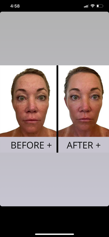 Beauty Focus Collagen