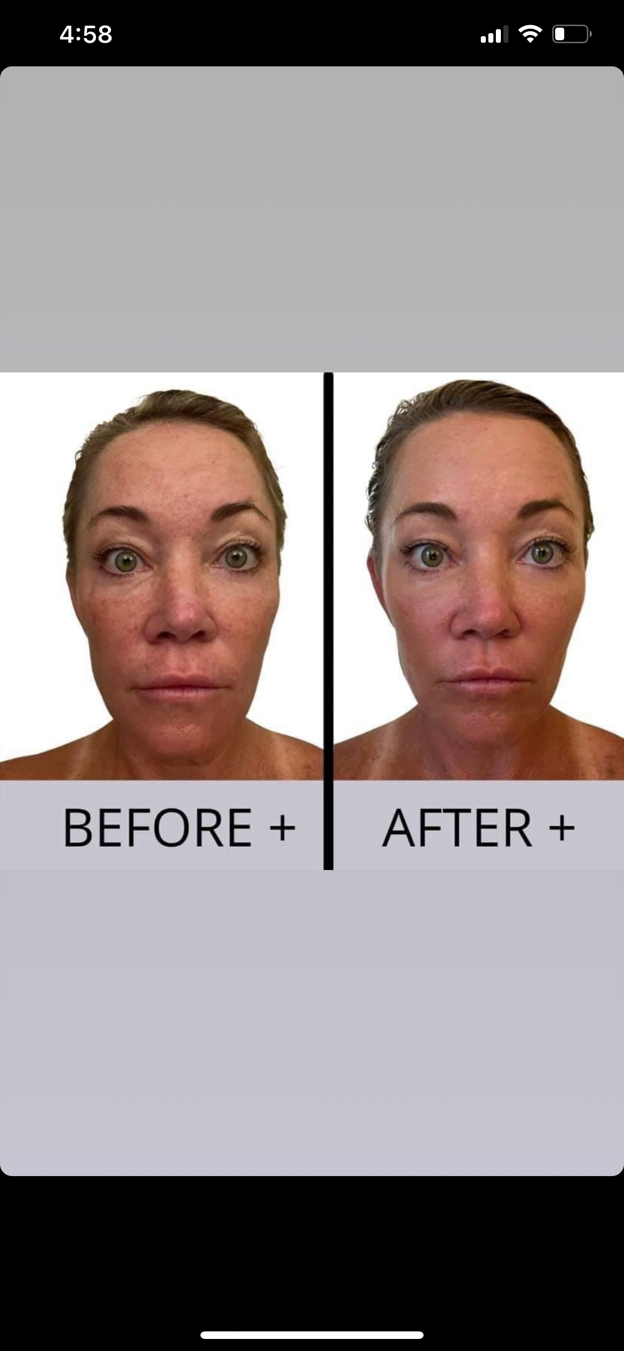 Beauty Focus Collagen - LIMITED DEAL!!